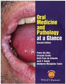 تصویر کتاب Oral Medicine and pathology at a Glance