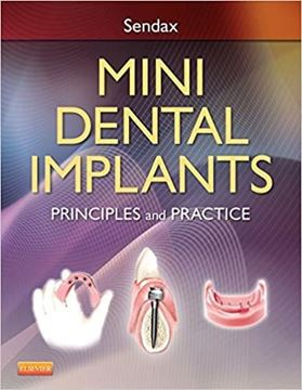 کتاب Mini Dentai Implants Principles and practices