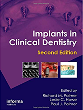 تصویر کتاب Implants in Clinical Dentistry 2nd ed