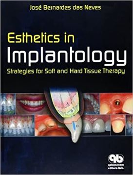 کتاب Esthetics in Implantology- strategies for soft and hard tissue therapy