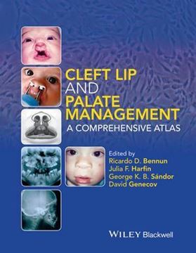 کتاب Cleft Lip and Palate Management A Comprehensive Atlasn