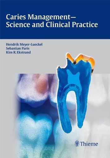 کتاب Caries Management Science and clinical practice