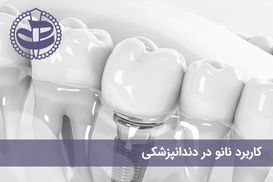 نقش و کاربرد نانو در دندانپزشکی